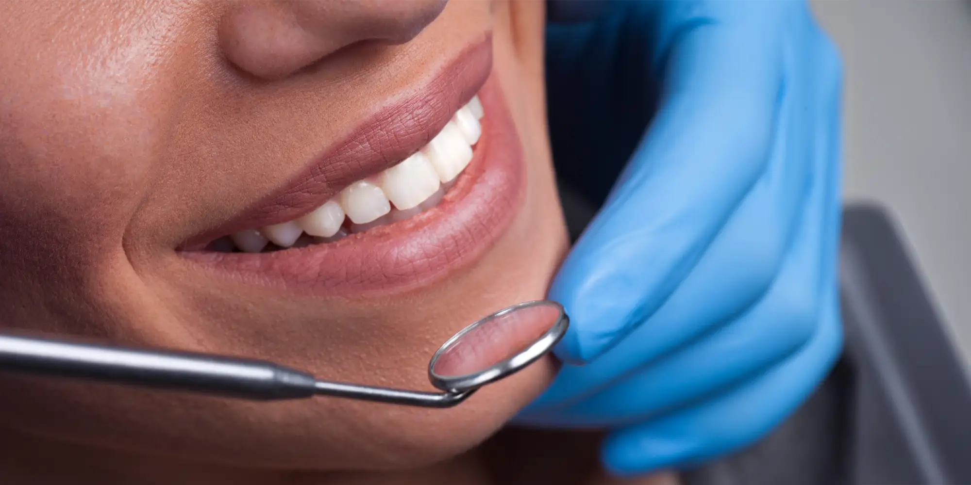 Dental Noblesville IN Smiling Woman